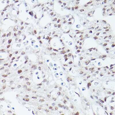 Immunohistochemistry-Paraffin: Islet-1 Antibody (1G9Q8) [NBP3-15315] - Immunohistochemistry of paraffin-embedded mouse fetal Heart using Islet-1 Rabbit mAb (NBP3-15315) at dilution of 1:100 (40x lens).Perform high pressure antigen retrieval with 10 mM citrate buffer pH 6.0 before commencing with IHC staining protocol.