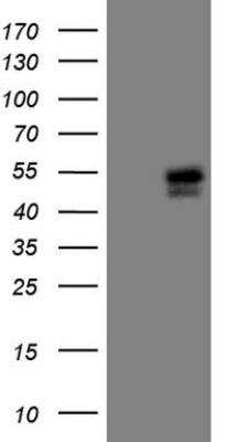 Western Blot: Islet-1 Antibody (2D8) [NBP2-45452] - Analysis of HEK293T cells were transfected with the pCMV6-ENTRY control (Left lane) or pCMV6-ENTRY Islet-1.