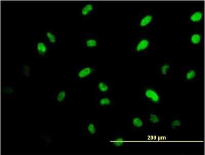 Immunocytochemistry/Immunofluorescence: Islet-1 Antibody (2E7) [H00003670-M05] - Analysis of monoclonal antibody to ISL1 on HeLa cell. Antibody concentration 10 ug/ml