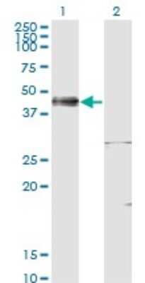 Western Blot: Islet-1 Antibody (4A7) [H00003670-M02] - Analysis of ISL1 expression in transfected 293T cell line by ISL1 monoclonal antibody (M02), clone 4A7.Lane 1: ISL1 transfected lysate(38.7 KDa).Lane 2: Non-transfected lysate.