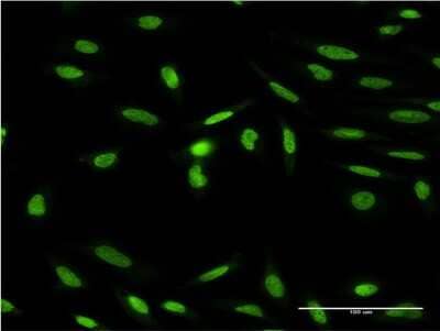 Immunocytochemistry/Immunofluorescence: Islet-1 Antibody (8A3) [H00003670-M03] - Analysis of monoclonal antibody to ISL1 on HeLa cell. Antibody concentration 10 ug/ml