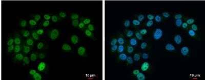 Immunocytochemistry/Immunofluorescence: Islet-1 Antibody [NBP2-14999] - SK-N-AS cells were fixed in 4% paraformaldehyde at RT for 15 min.Green: Islet 1 protein stained by Islet 1 antibody diluted at 1:500. Blue: Hoechst 33342 staining. Scale bar = 10 um.