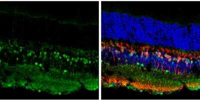 Immunohistochemistry-Frozen: Islet-1 Antibody [NBP2-14999] - Frozen sectioned adult mouse retina. Green: Islet 1 protein stained by Islet 1 antibody diluted at 1:250. Red: Protein kinase C alpha staining. Blue: Fluoroshield with DAPI. 