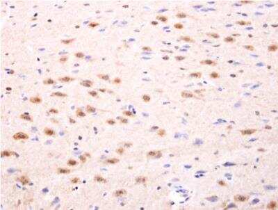 Immunohistochemistry-Paraffin: Islet-1 Antibody [NBP2-14999] -  Rat fore brain.  Islet 1 antibody dilution: 1:100.  Antigen Retrieval: Trilogy™ (EDTA based, pH 8.0) buffer, 15min