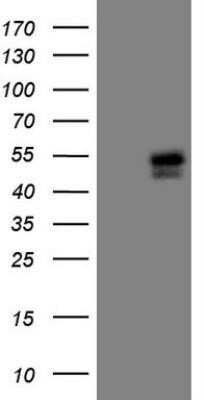 Western Blot: Islet-1 Antibody (OTI2D8) - Azide and BSA Free [NBP2-71050] - Analysis of HEK293T cells were transfected with the pCMV6-ENTRY control (Left lane) or pCMV6-ENTRY Islet-1.