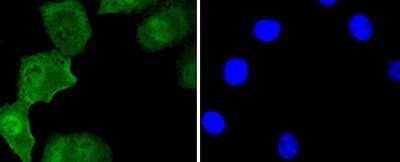 Immunocytochemistry/Immunofluorescence: Islet-1 Antibody (SC05-64) [NBP2-67576] - Staining Islet 1 in A549 cells (green). The nuclear counter stain is DAPI (blue). Cells were fixed in paraformaldehyde, permeabilised with 0.25% Triton X100/PBS.