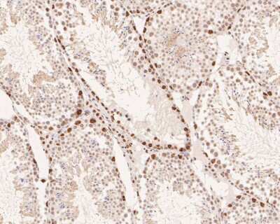 Immunohistochemistry-Paraffin: Islet-1 Antibody (SC05-64) [NBP2-67576] - Analysis of paraffin-embedded mouse testis tissue with Rabbit anti-Islet-1 antibody washed with ddH2O and PBS, and then probed with the primary antibody  at 1/200 dilution for 1 hour at room temperature. The detection was performed using an HRP conjugated compact polymer system. DAB was used as the chromogen. Tissues were counterstained with hematoxylin and mounted with DPX.