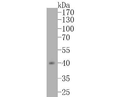 Western Blot: Islet-1 Antibody (SC05-64) [NBP2-67576] - Western blot analysis of Islet-1 on MCF-7 cell lysates. Proteins were transferred to a PVDF membrane and blocked with 5% BSA in PBS for 1 hour at room temperature. The primary antibody (1/500) was used in 5% BSA at room temperature for 2 hours. Goat Anti