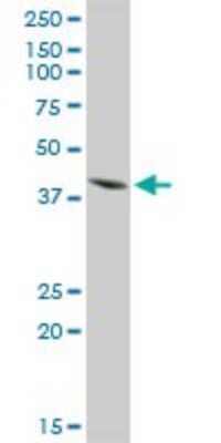 Western Blot: Islet-1 Antibody [H00003670-D01P] - Analysis of ISL1 expression in rat brain.