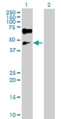 Western Blot: Islet-1 Antibody [H00003670-D01P] - Analysis of ISL1 expression in transfected 293T cell line by ISL1 polyclonal antibody.Lane 1: ISL1 transfected lysate(38.70 KDa).Lane 2: Non-transfected lysate.