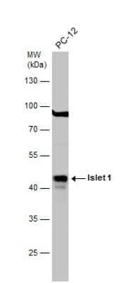 Western Blot: Islet-1 Antibody [NBP2-14999] - Whole cell extract (30 ug) was separated by 10% SDS-PAGE, and the membrane was blotted with Islet 1 antibody  diluted at 1:1000. The HRP-conjugated anti-rabbit IgG antibody was used to detect the primary antibody.