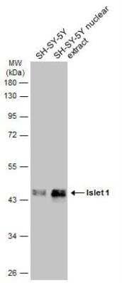 Western Blot: Islet-1 Antibody [NBP2-14999] - SH-SY5Y whole cell and nuclear extracts (30 ug) were separated by 10% SDS-PAGE, and the membrane was blotted with Islet 1 antibody diluted at 1:10000. The HRP-conjugated anti-rabbit IgG antibody (NBP2-19301) was used to detect the primary antibody.