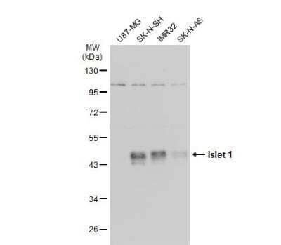 Western Blot: Islet-1 Antibody [NBP2-14999] - Various whole cell extracts (30 ug) were separated by 10% SDS-PAGE, and the membrane was blotted with Islet 1 antibody diluted at 1:10000. The HRP-conjugated anti-rabbit IgG antibody (NBP2-19301) was used to detect the primary antibody.