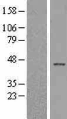 Western Blot: Islet 1 Overexpression Lysate (Adult Normal) [NBL1-12050] Left-Empty vector transfected control cell lysate (HEK293 cell lysate); Right -Over-expression Lysate for Islet 1.