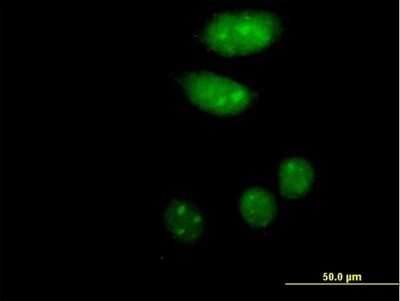Immunocytochemistry/Immunofluorescence: Islet-2 Antibody [H00064843-B01P] - Analysis of purified antibody to ISL2 on HeLa cell. (antibody concentration 10 ug/ml)