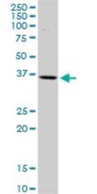 Western Blot: Islet-2 Antibody [H00064843-D01P] - Analysis of ISL2 expression in human kidney.