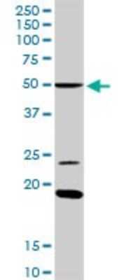 Western Blot: Islet-2 Antibody [H00064843-D01P] - Analysis of ISL2 expression in mouse liver.
