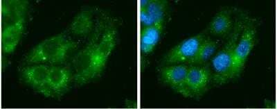 Immunocytochemistry/Immunofluorescence: Isocitrate Dehydrogenase 1/IDH1 Antibody (1521) [NBP2-43692] -  HepG2 cells were fixed in 4% paraformaldehyde at RT for 15 min. Green: IDH1 protein stained by IDH1 antibody [1521] diluted at 1:500. Blue: Hoechst 33342 staining.