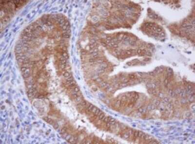 Immunohistochemistry: Isocitrate Dehydrogenase 1/IDH1 Antibody (1D1) [NBP2-46019] - Analysis of Human endometrium tissue.