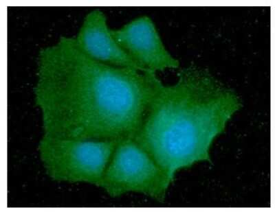 Immunocytochemistry/Immunofluorescence: Isocitrate Dehydrogenase 1/IDH1 Antibody (25H10) [NBP2-59427] - Analysis of IDH1 in Hep3B cells line, stained with DAPI (Blue) for nucleus staining and monoclonal anti-human IDH1 antibody (1:100) with goat anti-mouse IgG-Alexa fluor 488 conjugate (Green).