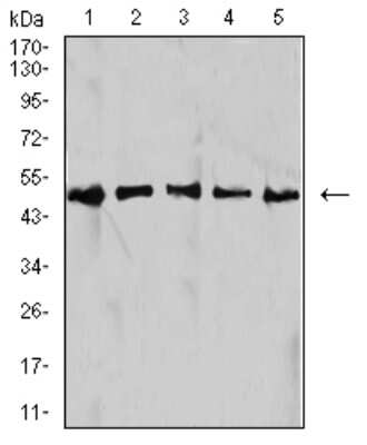 Western Blot: Isocitrate Dehydrogenase 1/IDH1 Antibody (7G8A1) [NBP2-61795] - Analysis using IDH1 mouse mAb against HepG2 (1), NIH/3T3 (2), C2C12 (3), COS7 (4), and SW480 (5) cell lysate.