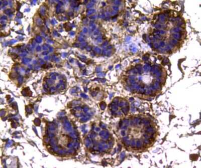 Immunohistochemistry-Paraffin: Isocitrate Dehydrogenase 1/IDH1 Antibody (A11-B4) [NBP2-66911] - Analysis of paraffin-embedded human breast tissue using anti-IDH1 antibody. Counter stained with hematoxylin.