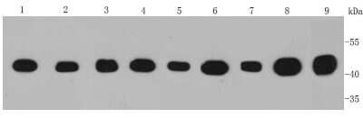 Western Blot: Isocitrate Dehydrogenase 1/IDH1 Antibody (A11-B4) [NBP2-66911] - Analysis of IDH1 on different cell lysates using anti-IDH1 antibody at 1/1000 dilution. Positive control: Lane 1: Hela Lane 2: HepG2 Lane 3: A431 Lane 4: MCF-7 Lane 5: A549 Lane 6: Jurkat Lane 7: Human kidney Lane 8: Human brain Lane 9: Human liver
