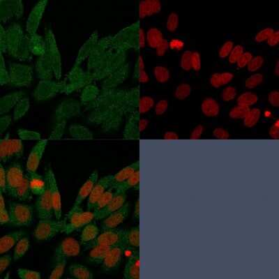 Immunocytochemistry/Immunofluorescence: Isocitrate Dehydrogenase 1/IDH1 Antibody (IDH1/1152) - Azide and BSA Free [NBP2-47744] - Immunofluorescence Analysis of PFA-fixed HeLa cells labeling IDH1. Isocitrate Dehydrogenase 1/IDH1 antibody (IDH1/1152) followed by goat anti-mouse IgG-CF488 (green). Nuclei counterstained with RedDot.