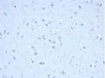 Immunohistochemistry-Paraffin: Isocitrate Dehydrogenase 1/IDH1 Antibody (IDH1/6806R) [NBP3-13943] - IHC analysis of formalin-fixed, paraffin-embedded human cerebellum. Negative tissue control using Isocitrate Dehydrogenase 1/IDH1 antibody (IDH1/6806R) at 2ug/ml in PBS for 30min RT.  HIER: Tris/EDTA, pH9.0, 45min. HRP-polymer, 30min. DAB, 5min.