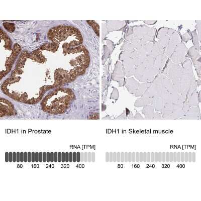 <b>Orthogonal Strategies Validation. </b>Immunohistochemistry-Paraffin: Isocitrate Dehydrogenase 1/IDH1 Antibody [NBP1-87428] - Staining in human prostate and skeletal muscle tissues.. Corresponding IDH1 RNA-seq data are presented for the same tissues.