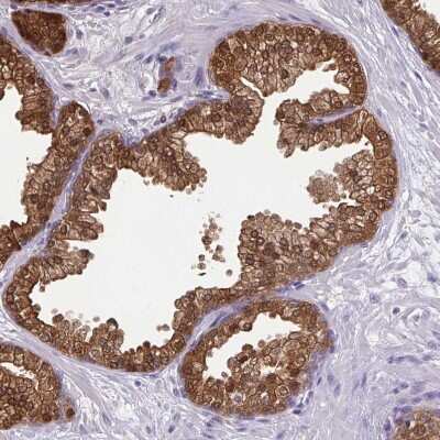 Immunohistochemistry-Paraffin: Isocitrate Dehydrogenase 1/IDH1 Antibody [NBP1-87428] - Staining of human prostate shows strong positivity in glandular cells.