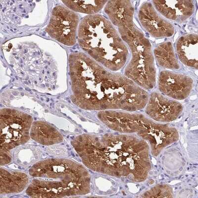 <b>Genetic Strategies Validation. </b>Immunohistochemistry-Paraffin: Isocitrate Dehydrogenase 1/IDH1 Antibody [NBP1-87428] - Staining of human kidney shows moderate positivity in cells in tubules.