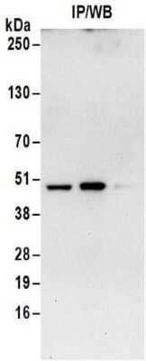 <b>Biological Strategies Validation. </b>Immunoprecipitation: Isocitrate Dehydrogenase 1/IDH1 Antibody [NBP2-32150] - Samples: Whole cell lysate (1 mg for IP; 20% of IP loaded) from Jurkat cells. Antibodies:  Affinity purified rabbit anti-Isocitrate dehydrogenase antibody NBP2-32150 used for IP at 6 ug/mg lysate. For blotting immunoprecipitated Isocitrate dehydrogenase, NBP2-32150 was used at 1 ug/ml. Detection: Chemiluminescence with an exposure time of 30 seconds.