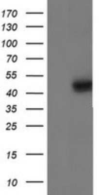 Western Blot: Isocitrate Dehydrogenase 1/IDH1 Antibody (OTI1D1) - Azide and BSA Free [NBP2-70990] - Analysis of HEK293T cells were transfected with the pCMV6-ENTRY control (Left lane) or pCMV6-ENTRY IDH1.