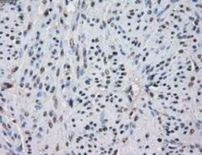 Immunohistochemistry: Isocitrate Dehydrogenase 1/IDH1 Antibody (OTI2H9) - Azide and BSA Free [NBP2-70988] - Endometrium tissue.