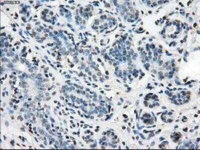 Immunohistochemistry: Isocitrate Dehydrogenase 1/IDH1 Antibody (OTI2H9) - Azide and BSA Free [NBP2-70988] - Staining of paraffin-embedded breast tissue using anti-Isocitrate dehydrogenase mouse monoclonal antibody.