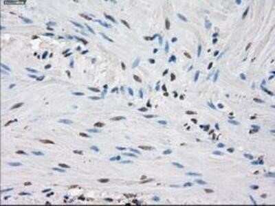 Immunohistochemistry: Isocitrate Dehydrogenase 1/IDH1 Antibody (OTI2H9) - Azide and BSA Free [NBP2-70988] - Staining of paraffin-embedded endometrium tissue using anti-Isocitrate dehydrogenase mouse monoclonal antibody.