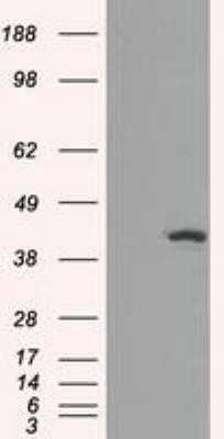 Western Blot: Isocitrate Dehydrogenase 1/IDH1 Antibody (OTI2H9) - Azide and BSA Free [NBP2-70988] - HEK293T cells were transfected with the pCMV6-ENTRY control (Left lane) or pCMV6-ENTRY Isocitrate dehydrogenase(Right lane) cDNA for 48 hrs and lysed. Equivalent amounts of cell lysates (5 ug per lane) were separated by SDS-PAGE and immunoblotted with ant