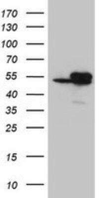 Western Blot: Isocitrate Dehydrogenase 1/IDH1 Antibody (OTI3G9) [NBP2-46018] - HEK293T cells were transfected with the pCMV6-ENTRY control (left lane) or pCMV6-ENTRY IDH1 (RC210582, right lane) cDNA for 48 hrs and lysed. Equivalent amounts of cell lysates (5 ug per lane) were separated by SDS-PAGE and immunoblotted with anti-IDH1.