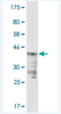 Western Blot: Isopeptidase T/USP5 Antibody (4G4) [H00008078-M02] - Detection against Immunogen (37.84 KDa) .