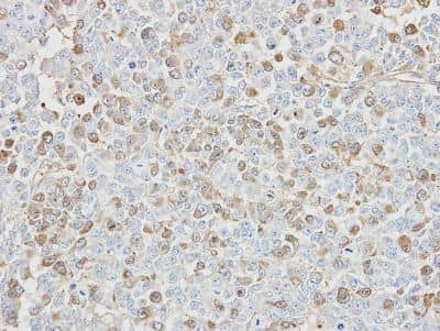 Immunohistochemistry-Paraffin: Isopeptidase T/USP5 Antibody [NBP1-32590] - TOV-112D xenograft, using USP5 antibody at 1:500 dilution. Antigen Retrieval: Citrate buffer, pH 6.0, 15 min. 