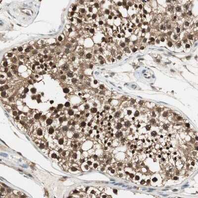 Immunohistochemistry-Paraffin: Isopeptidase T/USP5 Antibody [NBP1-83089] - Staining of human testis shows strong nuclear and cytoplasmic positivity in cells in seminiferus ducts.