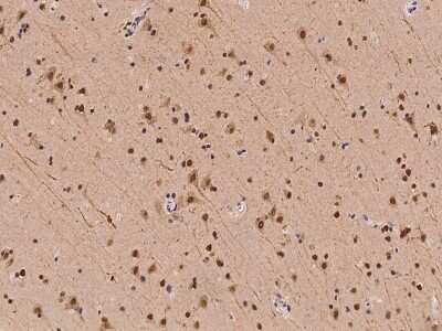 Immunohistochemistry-Paraffin: Isopeptidase T/USP5 Antibody [NBP2-97889] - Immunochemical staining of human Isopeptidase T/USP5 in human brain with rabbit polyclonal antibody at 1:100 dilution, formalin-fixed paraffin embedded sections.