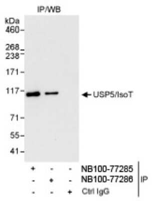 <b>Independent Antibodies Validation. </b>Immunoprecipitation: Isopeptidase T/USP5 Antibody [NB100-77286] - Detection of Human USP5 by Western Blot of Immunoprecipitates. Samples: Whole cell lysate (1 mg for IP, 20% of IP loaded) from HeLa cells. Antibodies: Affinity purified rabbit anti-USP5 antibody Nb100-77286 used for IP at 3 ug/mg lysate. USP5 was also immunoprecipitated by rabbit anti-USP5 antibody NB100-77285, which recognizes an upstream epitope. Detection: Chemiluminescence with an exposure time of 30 seconds.