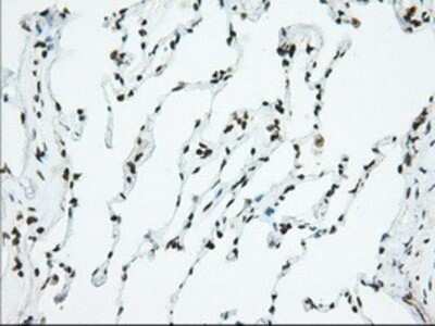 Immunohistochemistry: Isopeptidase T/USP5 Antibody (OTI2E3) - Azide and BSA Free [NBP2-71355] - Staining of paraffin-embedded Human lung tissue using anti-USP5 mouse monoclonal antibody.