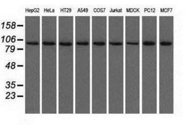 Western Blot: Isopeptidase T/USP5 Antibody (OTI2E3) - Azide and BSA Free [NBP2-71355] - Analysis of extracts (35ug) from 9 different cell lines by using anti-USP5 monoclonal antibody.