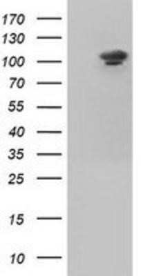 Western Blot: Isopeptidase T/USP5 Antibody (OTI2E3) - Azide and BSA Free [NBP2-71355] - HEK293T cells were transfected with the pCMV6-ENTRY control (Left lane) or pCMV6-ENTRY USP5 (Right lane) cDNA for 48 hrs and lysed. Equivalent amounts of cell lysates (5 ug per lane) were separated by SDS-PAGE and immunoblotted with anti-USP5.