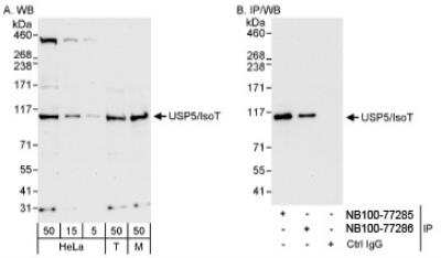 Western Blot: Isopeptidase T/USP5 Antibody [NB100-77285] - Detection of Human and Mouse USP5/IsoT on HeLa whole cell lysate using NB100-77285. USP5/IsoT was also immunoprecipitated by rabbit anti-USP5/IsoT antibody NB100-77286.