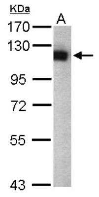 Western Blot: Isopeptidase T/USP5 Antibody [NBP1-32590] - Sample (50 ug of whole cell lysate) A: Mouse brain 7. 5% SDS PAGE; antibody diluted at 1:1000.