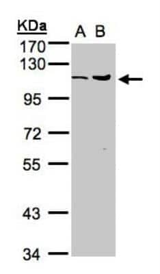 Western Blot: Isopeptidase T/USP5 Antibody [NBP1-32590] - Sample(30 ug whole cell lysate)A:MOLT4  B:Raji  7. 5% SDS PAGE, antibody diluted at 1:1000.